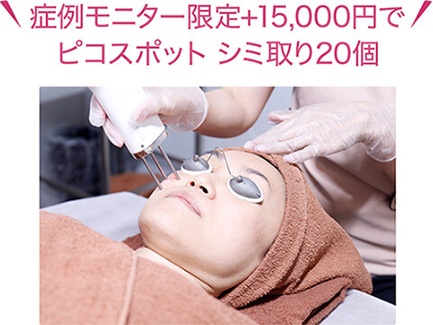 症例モニター限定+15,000円でピコスポット シミ取り20個