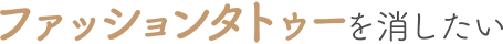 ファッションタトゥーを消したい